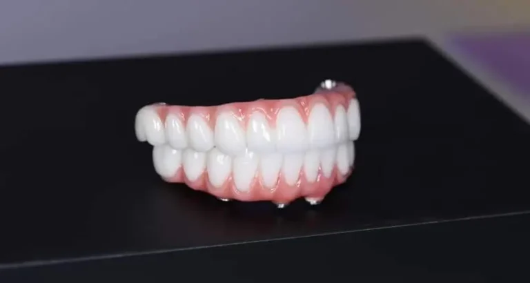 All-On-4-Plus-vs-Traditional-Dentures-A-Chewing-Efficiency-Comparison-Sunbury-Dental-House