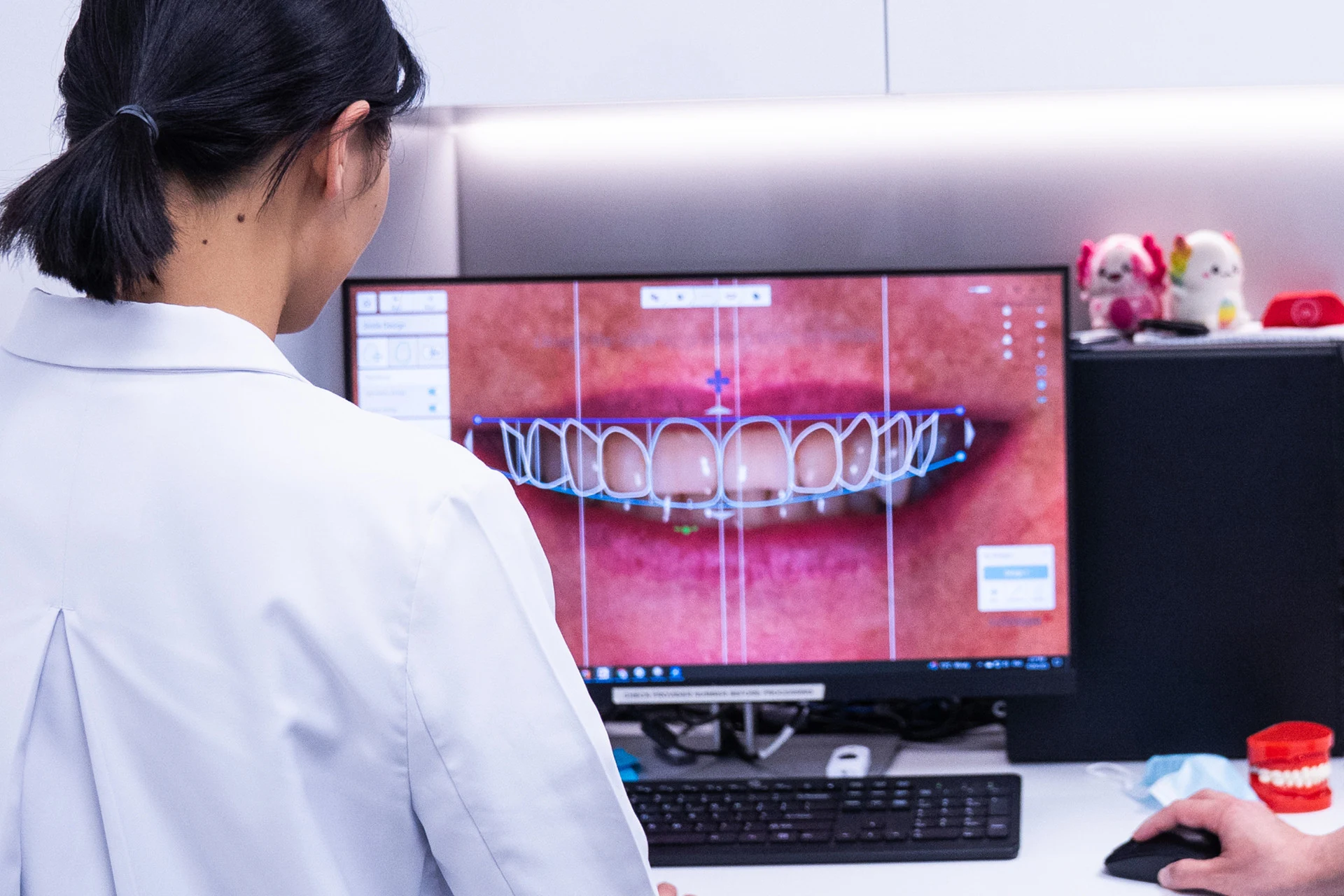 Digital Smile Design