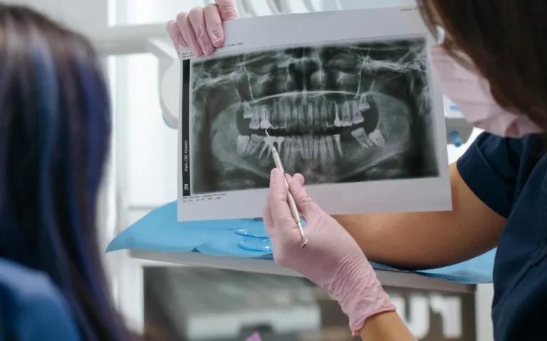 Having-A-Dental-X-Ray-Sweet-Stick-A-Fruit-Roll-Up-In-Your-Mouth-At-Sunbury-Dental-House-In-Sunbury-1
